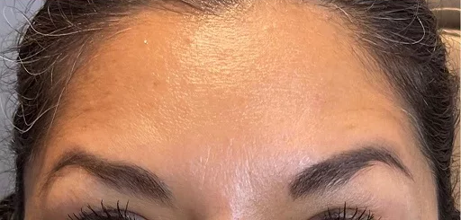 Silikonové náplasti proti vráskám – oči a čelo (balíček)